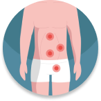 Emergency Hernia Surgery