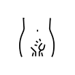 Inguinal Hernia