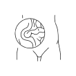 Ventral Hernia